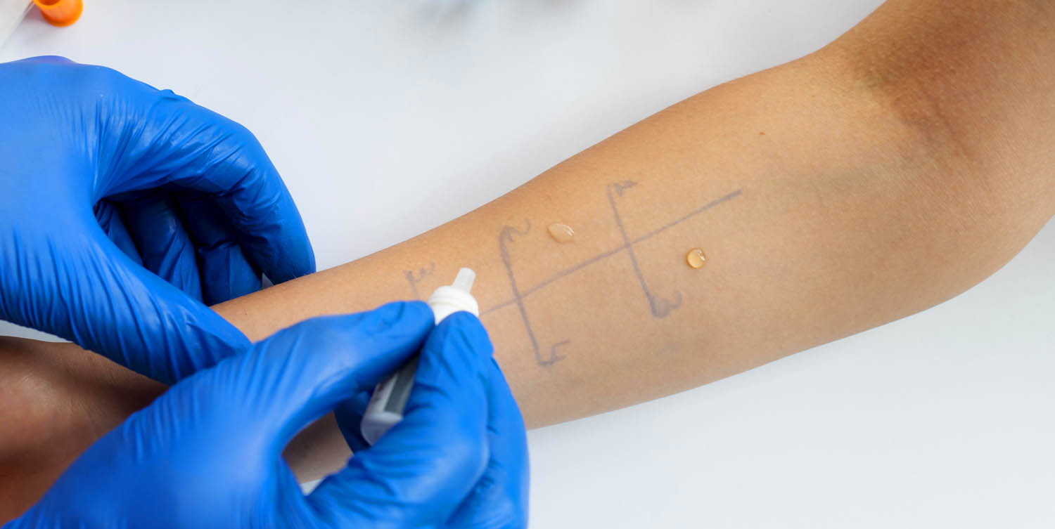 Allergy Testing & Treatment